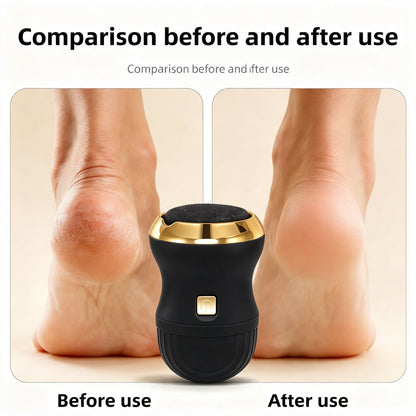 Luminary Silque: Precision Electric Foot Renewal System